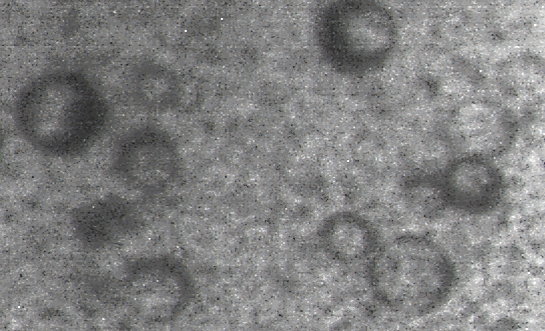 Fig 2. TEM of Escherichia coli lytic phage structure