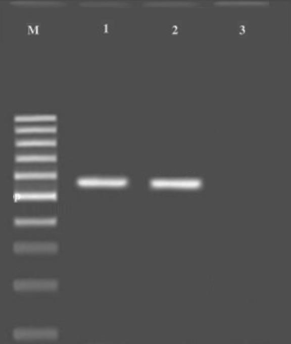 Figure 1. Gel electrophoresis of the PCR products. M: Molecular ladder; 1: Positive control; 2: S. Tm band at 432 bp; 3: Negative control