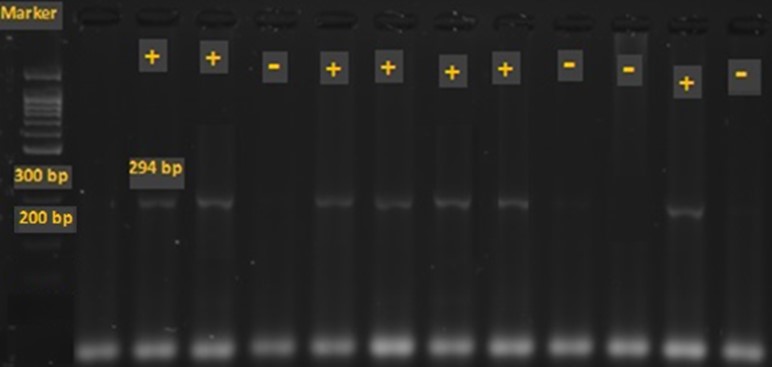 Figure 1. The electrophoretic pattern of the PCR product of glmM gene. The length of amplified fragment by glmM primers is 294 bp. The first column shows the ladder of 100 bp. The samples of 2, 3 and 5-8 and 11 are positive for glmM and 1, 4 and 9, 10, 12 are negative for this gene.
