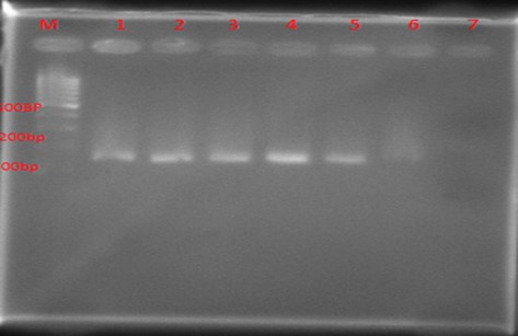 Figure 2. Results of PCR product electrophoresis on gel electrophoresis for pvl gene: 100 bp marker was used in lane M. Lane1 was a standard strain, 29213 ATCC. Lanes 2 to 6 strains of S. aureus clinically containing pvl gene (fragment length 180).